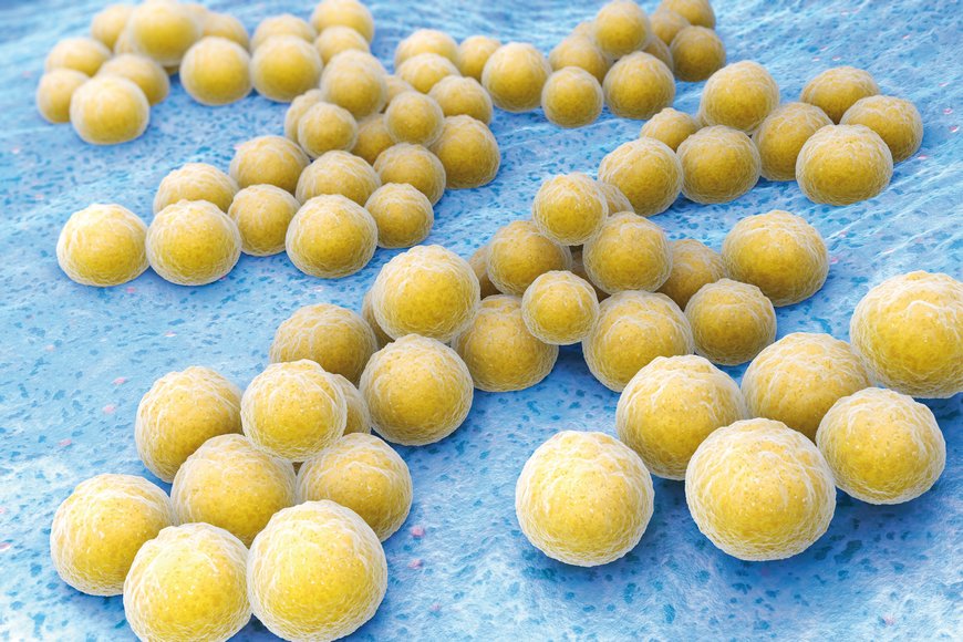 Gamme SAN – Antimicrobial  de ELESA : des composants auto-assainissants contre les bactéries et les champignons. 